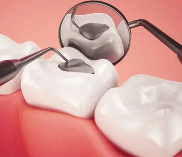 ترمیم-دندان