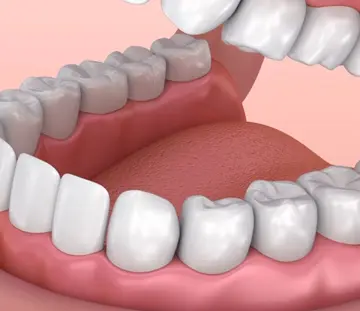 زیبایی-دندان